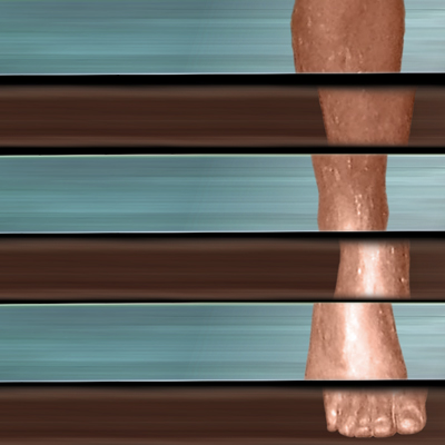 Slats